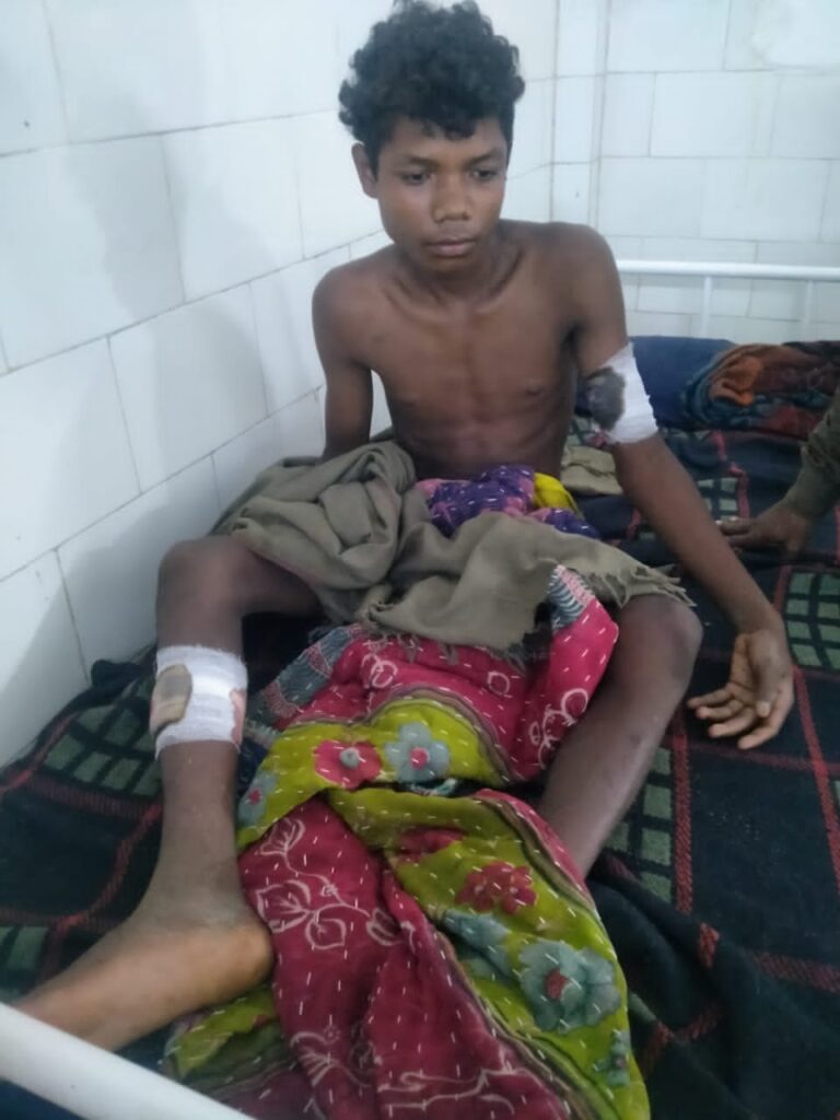 भालू के हमले में घायल युवक का अस्पताल में चल रहा उपचार