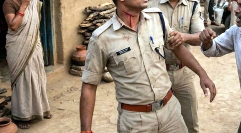 पत्नी से मारपीट रोकने पहुंचे डायल-112 के आरक्षक पर हमला, गले और चेहरे पर आई चोटें; आरोपी पर FIR